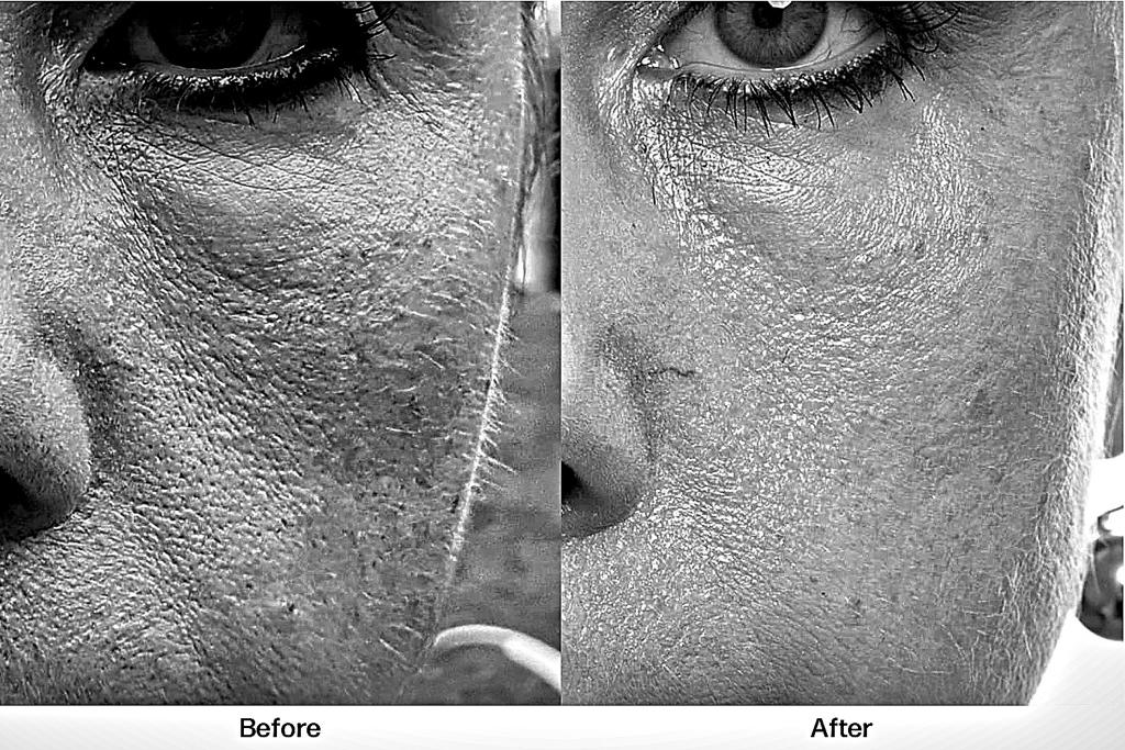 Nicky's Experience Using ACTEVNA®